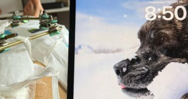 Lindsey Vonn shares nervous post as she awaits fifth surgery on broken leg after Olympic fall and dog's death