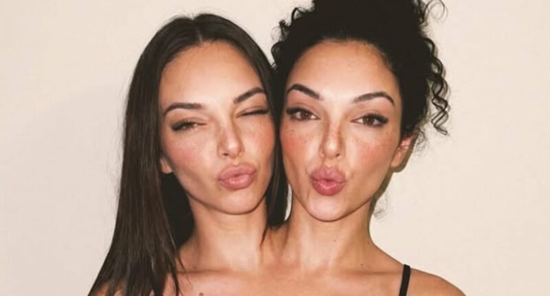 Millions have been fooled by beautiful AI-generated conjoined twin influencers... but the reality of the rare birth defect is anything but glamorous