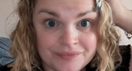 Mother-of-two, 38, was told extreme hair loss was 'mummy issues' but it was symptom of common mineral deficiency: 'I assumed I was weak'