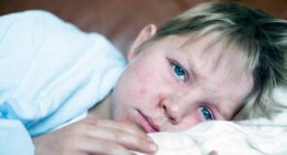 NHS vaccine alert as 'big outbreak' of 'Victorian-era' illness confirmed in London