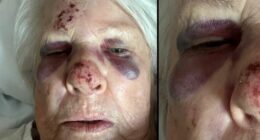 A﻿n eldery woman has been left brusied and with a brain bleed after she was hit by a child on an e-bike.