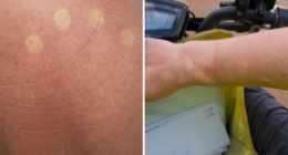 Posties told to stop wearing uniforms amid reports they're getting sunburnt