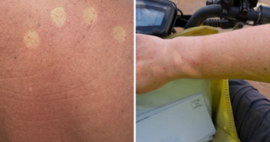 Posties told to stop wearing uniforms amid reports they're getting sunburnt