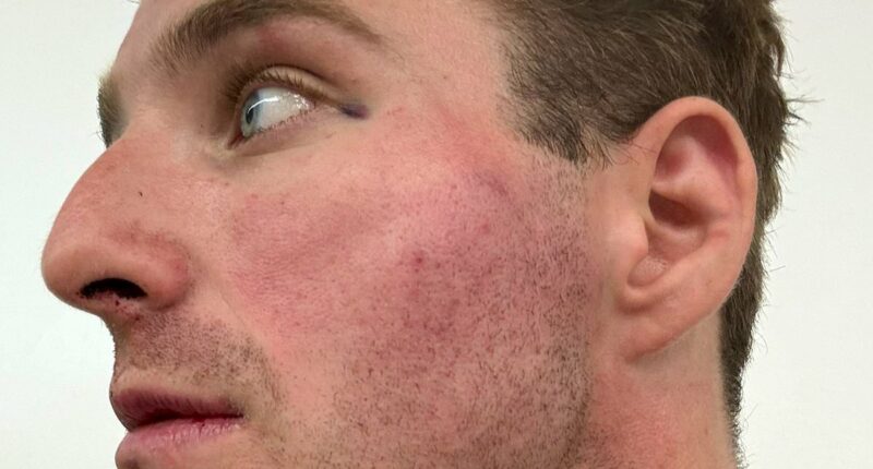 Roald Dahl's police officer grandson blasts Met over botched case