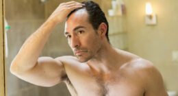 The cure for baldness is finally here: Doctors hail 'gamechanger' lotion with NO major side-effects or sex-drive impact that can regrow hair by more than 500pc. Special report by WILL STODDART