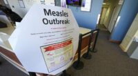 US hits grim measles milestone with nearly 1,000 cases in TWO months