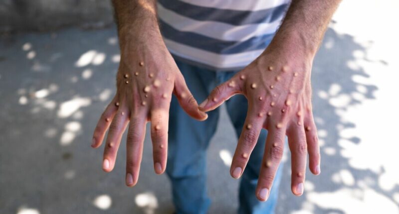 Warning issued as cases of deadly virus increase in 2 UK areas