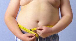 What happened to the children who went to fat camps: They've fallen out of favour - but Destiny says her stint changed her life. Now, as childhood obesity soars, is it time to bring them back?