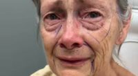 70-year-old woman's dramatic facelift results leave internet stunned