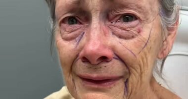 70-year-old woman's dramatic facelift results leave internet stunned