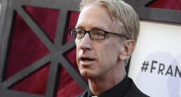 Andy Dick has ‘5 to 7 holes’ in his brain after L.A. overdose
