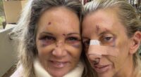 Brave women united in recovery after horrifying attack by celebrity dentist