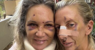 Brave women united in recovery after horrifying attack by celebrity dentist