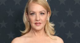 Bridesmaids star says she missed Oscars reunion for plastic surgery