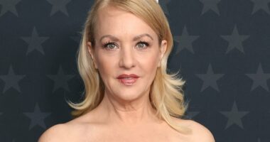 Bridesmaids star says she missed Oscars reunion for plastic surgery