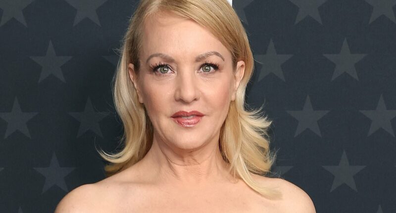 Bridesmaids star says she missed Oscars reunion for plastic surgery