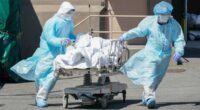 COVID-19 death toll in early days of the pandemic undercounted by over 150K: study