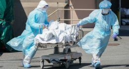 COVID-19 death toll in early days of the pandemic undercounted by over 150K: study