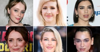 Can you guess what these stars did to take years off their faces? It's not Botox or fillers, but it's as good as a facelift (and even Queen Camilla is a fan!)