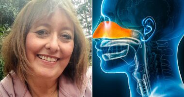 Constantly bunged up? It sounds grotesque but could a 'snot transplant' be the answer... Experts reveal their step-by-step guide to beating sinusitis... and the signs your sniffles are NOT just a cold