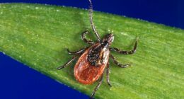 Experts warn of rising tick-borne illness that is more of a threat than Lyme disease