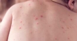 Health chief's concerning three-word message as world's most infectious disease rips across CA