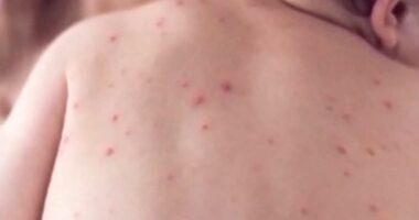 Health chief's concerning three-word message as world's most infectious disease rips across CA