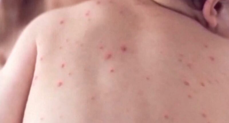 Health chief's concerning three-word message as world's most infectious disease rips across CA