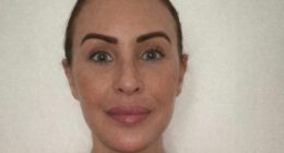 I paid £10,000 for a facelift in Turkey - cruel trolls say it's made me look older