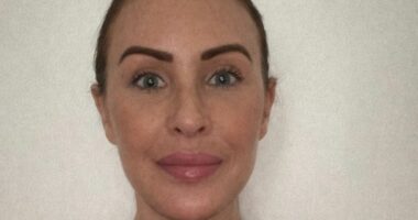 I paid £10,000 for a facelift in Turkey - cruel trolls say it's made me look older