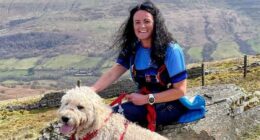 I was tortured by psoriasis for 20 years. Then I found a simple cure