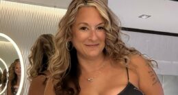 Internet star mom, 47, dies after tummy tuck surgery