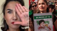 Iranian Mersedeh Shahinkar, who lost her eye, slams Kamala Harris' response to the bombing