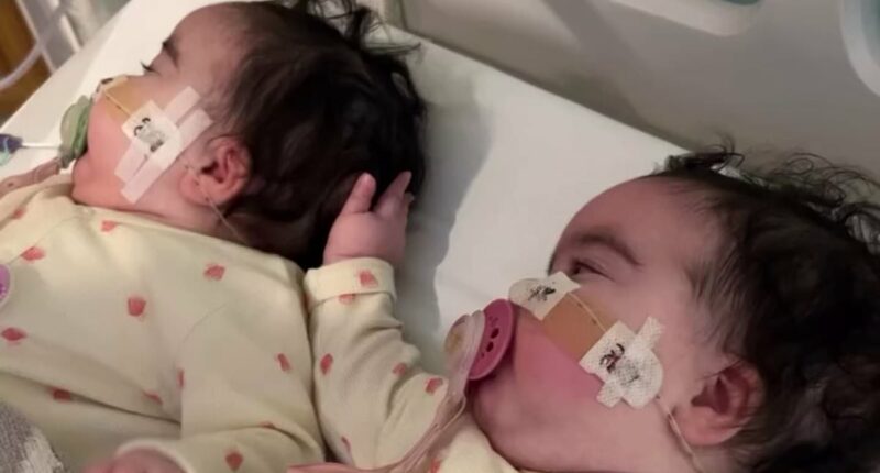 Jesy Nelson shares new snaps of her twin daughters with their splints