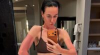 Katy Perry shares painful looking picture of her sunburn after going on ski trip as she poses for rare picture with her daughter Daisy Dove