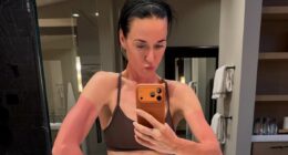 Katy Perry shares painful looking picture of her sunburn after going on ski trip as she poses for rare picture with her daughter Daisy Dove