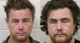 Man Who Gouged Out Both His Eyes, Bit Off Part of Tongue Declared Competent to Stand Trial