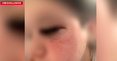 Girl attacked at Shellharbour shopping centre