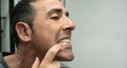 NHS GP Amir Khan's alert over brushing your teeth