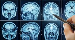 Outrage as cancer-fighting drug in US patent linked to hidden CIA file