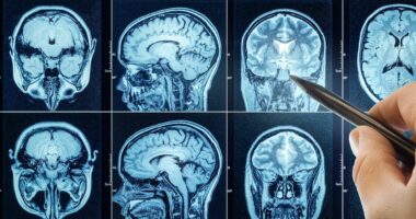 Outrage as cancer-fighting drug in US patent linked to hidden CIA file