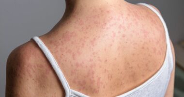 Panic as Victorian disease spreads across 50 UK areas – see map