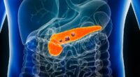Scientists uncover 'early warning signal' of pancreatic cancer