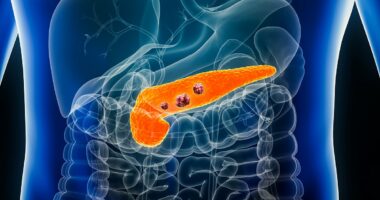 Scientists uncover 'early warning signal' of pancreatic cancer