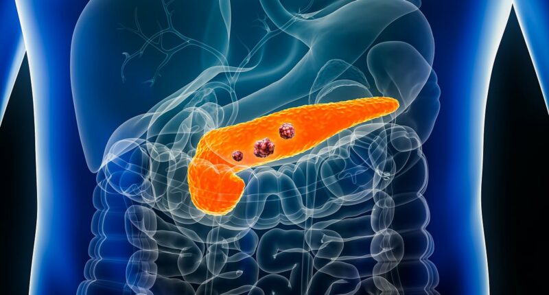 Scientists uncover 'early warning signal' of pancreatic cancer
