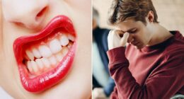 Teeth grinding at night affects millions, yet is so commonly misdiagnosed or ignored. Now experts say there's a key sign it's happening to you... and this is what you need to do about it