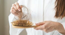 The hidden diet mistake behind rising hair loss in women - and how to fix it, according to experts
