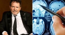 The terrifying condition that could be causing your shaky hands... DR PHILIPPA KAYE reveals the hidden danger behind the tremors - and the 30-second test you must take now