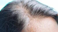 Thinning hair could be warning sign your body needs one thing