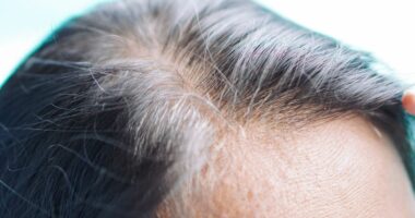 Thinning hair could be warning sign your body needs one thing